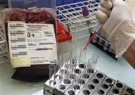 A technician tests blood samples at a laboratory in Marseille in this April 1, 2009 file photo. REUTERS/Jean-Paul Pelissier
A technician tests blood samples at a laboratory in Marseille in this April 1, 2009 file photo. REUTERS/Jean-Paul Pelissier