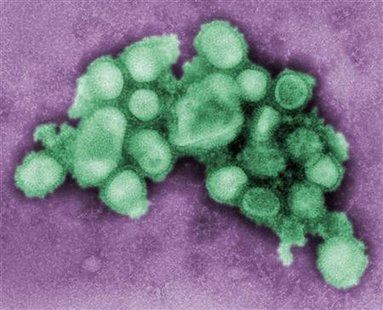 This preliminary negative stained transmission electron micrograph (TEM) image depicts some of the ultrastructural morphology of an H1N1 "swine flu" virus culture obtained from a California patient suffering from the current international flu outbreak, in an image obtained from the U.S. Centers for Disease Control (CDC) in Atlanta, April 28, 2009. REUTERS/C. S. Goldsmith and A. Balish/Centers for Disease Control/Handout
This preliminary negative stained transmission electron micrograph (TEM) image depicts some of the ultrastructural morphology of an H1N1 "swine flu" virus culture obtained from a California patient suffering from the current international flu outbreak, in an image obtained from the U.S. Centers for Disease Control (CDC) in Atlanta, April 28, 2009. REUTERS/C. S. Goldsmith and A. Balish/Centers for Disease Control/Handout