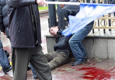 A victim of clashes between riot police and anti-government protesters is seen in Bishkek April 7, 2010. REUTERS/Vladimir Pirogov
A victim of clashes between riot police and anti-government protesters is seen in Bishkek April 7, 2010. REUTERS/Vladimir Pirogov