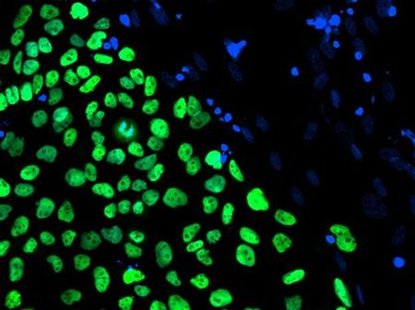 
A human embryonic stem cell line derived at Stanford University is seen in this handout photo released to Reuters by the California Institute for Regenerative Medicine, March 9, 2009. REUTERS/Julie Baker/Stanford University School of Medicine/California Institute for Regenerative Medicine/Handout
