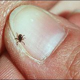 Deer tick Deer tick
