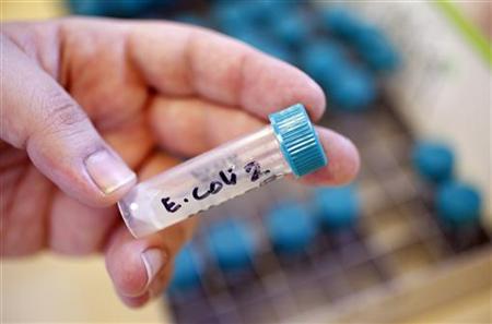 A sample bottle containing E. coli bacteria is seen at the Health Protection Agency in north London