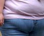 obesity