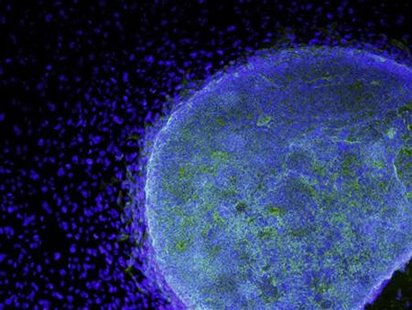 A microscopic view shows a colony of human embryonic stem cells growing on fibroblasts in this handout photo A microscopic view shows a colony of human embryonic stem cells growing on fibroblasts in this handout photo