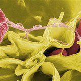 Salmonella Bacteria (Reuters)