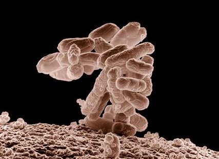 E. coli E. coli