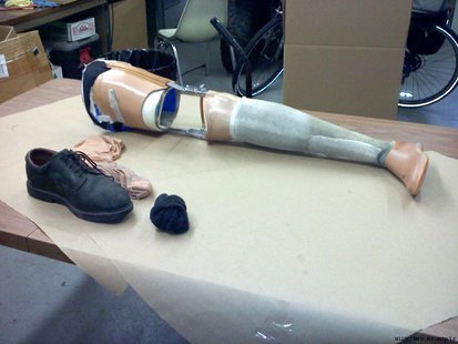 A prosthetic was leg was discovered August 2nd in a Menasha yard. (Photo courtesy Fox 11 WLUK-TV) A prosthetic was leg was discovered August 2nd in a Menasha yard. (Photo courtesy Fox 11 WLUK-TV)