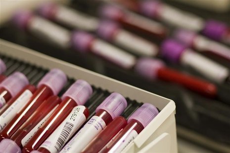 Blood samples are pictured at the Swiss Laboratory for Doping Analysis in Epalinges near Lausanne in this July 15, 2008 file photo. Blood samples are pictured at the Swiss Laboratory for Doping Analysis in Epalinges near Lausanne in this July 15, 2008 file photo.
