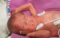 March of Dimes - March for Babies 26
