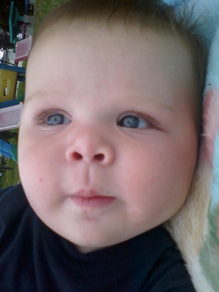 Brody h