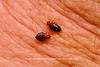 Lunchtime for bedbugs Lunchtime for bedbugs