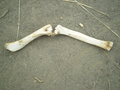 Human Bones Human Bones