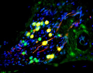 Human stem cell-derived otic neurons repopulating the cochlea of deaf gerbils are seen in this undated handout photo courtesy of the Univers Human stem cell-derived otic neurons repopulating the cochlea of deaf gerbils are seen in this undated handout photo courtesy of the Univers