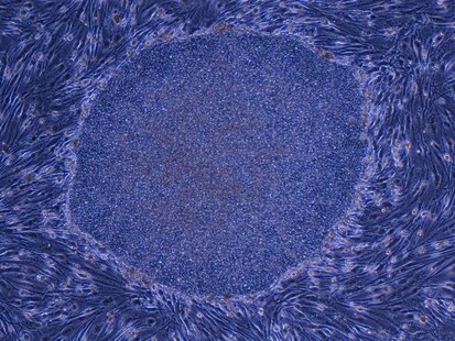 This undated handout photo shows iPS cells derived from adult human dermal fibroblasts released by Kyoto University Professor Shinya Yamanak This undated handout photo shows iPS cells derived from adult human dermal fibroblasts released by Kyoto University Professor Shinya Yamanak