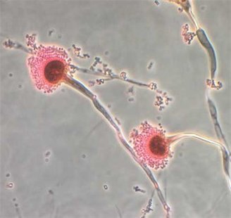 Aspergillus, a type of fungi, is seen in this handout image from the Centres for Disease Control, October 13, 2012. REUTERS/Centres for Dise Aspergillus, a type of fungi, is seen in this handout image from the Centres for Disease Control, October 13, 2012. REUTERS/Centres for Dise
