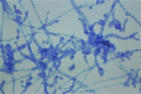 A sample of Cladosporium species, one of the fungi diagnosed in the fungal meningitis outbreak sweeping the United States, in Nashville, Ten A sample of Cladosporium species, one of the fungi diagnosed in the fungal meningitis outbreak sweeping the United States, in Nashville, Ten