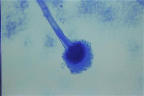 A sample of Aspergillus fumigatus, the first fungus diagnosed in the fungal meningitis outbreak sweeping the United States, in Nashville, Te A sample of Aspergillus fumigatus, the first fungus diagnosed in the fungal meningitis outbreak sweeping the United States, in Nashville, Te