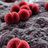 meningitis meningitis