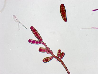 Exserohilum rostratum, a type of fungi, is seen in this handout image from the Centres for Disease Control, October 13, 2012. REUTERS/Centre Exserohilum rostratum, a type of fungi, is seen in this handout image from the Centres for Disease Control, October 13, 2012. REUTERS/Centre