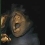 A 4D ultrasound scan shows a foetus yawning in the womb during a study by Durham and Lancaster Universities and released in Durham, northern A 4D ultrasound scan shows a foetus yawning in the womb during a study by Durham and Lancaster Universities and released in Durham, northern