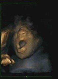 A 4D ultrasound scan shows a foetus yawning in the womb during a study by Durham and Lancaster Universities and released in Durham, northern A 4D ultrasound scan shows a foetus yawning in the womb during a study by Durham and Lancaster Universities and released in Durham, northern
