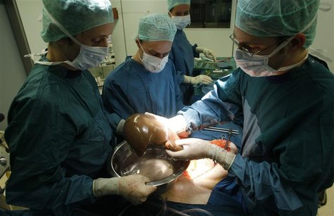 A surgeon holds the liver during an operation to extract the liver and the kidneys from a brain-dead women at the Unfallkrankenhaus Berlin ( A surgeon holds the liver during an operation to extract the liver and the kidneys from a brain-dead women at the Unfallkrankenhaus Berlin (