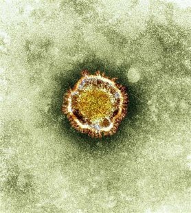 A electron microscope image of a coronavirus is seen in this undated picture provided by the Health Protection Agency in London February 19, A electron microscope image of a coronavirus is seen in this undated picture provided by the Health Protection Agency in London February 19,
