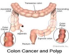 colon colon