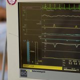 A surgery nurse is seen beside the heart beat monitor in the operating theatre of the Unfallkrankenhaus Berlin (UKB) hospital in Berlin Febr A surgery nurse is seen beside the heart beat monitor in the operating theatre of the Unfallkrankenhaus Berlin (UKB) hospital in Berlin Febr