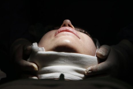 A woman lies on an operating table during a facelift surgery at a private plastic surgery clinic in Budapest, March 1, 2012. REUTERS/Bernade A woman lies on an operating table during a facelift surgery at a private plastic surgery clinic in Budapest, March 1, 2012. REUTERS/Bernade
