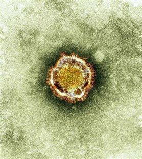 A electron microscope image of a coronavirus is seen in this undated picture provided by the Health Protection Agency in London February 19, A electron microscope image of a coronavirus is seen in this undated picture provided by the Health Protection Agency in London February 19,