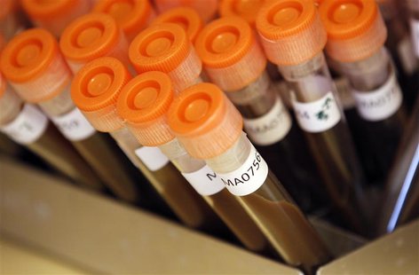 Test tubes filled with samples of bacteria to be tested are seen at the Health Protection Agency in north London in this March 9, 2011 file Test tubes filled with samples of bacteria to be tested are seen at the Health Protection Agency in north London in this March 9, 2011 file