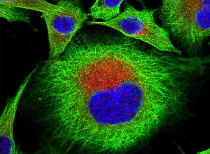 A cell infected with foot-and-mouth disease virus in an undated image courtesy of The Pirbright Institute. The virus is red, green is tubuli A cell infected with foot-and-mouth disease virus in an undated image courtesy of The Pirbright Institute. The virus is red, green is tubuli