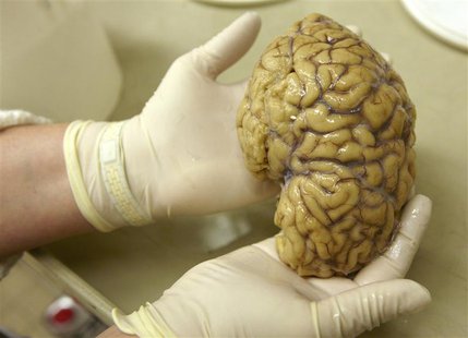 A laboratory assistant holds one hemisphere of a healthy brain in the Morphological unit of psychopathology in the Neuropsychiatry division A laboratory assistant holds one hemisphere of a healthy brain in the Morphological unit of psychopathology in the Neuropsychiatry division
