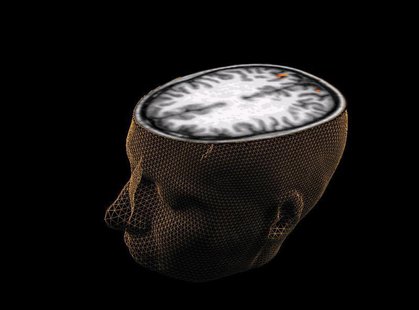 An undated image of the human brain taken through scanning technology. REUTERS/Sage Center for the Study of the Mind, University of Californ An undated image of the human brain taken through scanning technology. REUTERS/Sage Center for the Study of the Mind, University of Californ