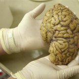 A laboratory assistant holds one hemisphere of a healthy brain in the Morphological unit of psychopathology in the Neuropsychiatry division A laboratory assistant holds one hemisphere of a healthy brain in the Morphological unit of psychopathology in the Neuropsychiatry division