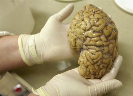 A laboratory assistant holds one hemisphere of a healthy brain in the Morphological unit of psychopathology in the Neuropsychiatry division A laboratory assistant holds one hemisphere of a healthy brain in the Morphological unit of psychopathology in the Neuropsychiatry division