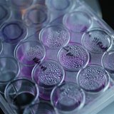 A tray containing cancer cells sits on an optical microscope in the Nanomedicine Lab at UCL's School of Pharmacy in London May 2, 2013. REUT A tray containing cancer cells sits on an optical microscope in the Nanomedicine Lab at UCL's School of Pharmacy in London May 2, 2013. REUT