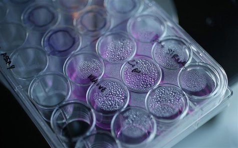 A tray containing cancer cells sits on an optical microscope in the Nanomedicine Lab at UCL's School of Pharmacy in London May 2, 2013. REUT A tray containing cancer cells sits on an optical microscope in the Nanomedicine Lab at UCL's School of Pharmacy in London May 2, 2013. REUT