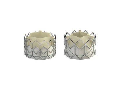 The original Edwards Lifesciences Sapien replacement heart valve (L) and the second generation Sapien XT, with modifications to enable impla The original Edwards Lifesciences Sapien replacement heart valve (L) and the second generation Sapien XT, with modifications to enable impla