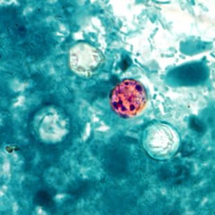 Cyclospora parasite (PHOTO CREDIT: Centers for Disease Control and Prevention) Cyclospora parasite (PHOTO CREDIT: Centers for Disease Control and Prevention)