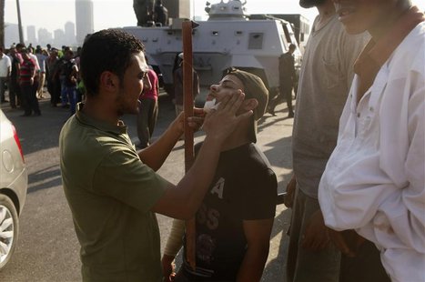 An opponent of deposed President Mohamed Mursi, dresses the wound of another opponent injured in Monday's clashes with pro-Mursi protesters, An opponent of deposed President Mohamed Mursi, dresses the wound of another opponent injured in Monday's clashes with pro-Mursi protesters,