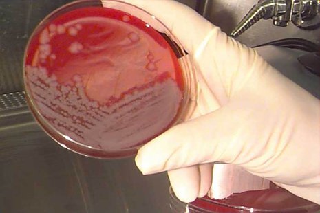 An anthrax culture. An anthrax culture.