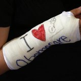 Cathey Park of Cambridge, Massachusetts shows her cast signed by U.S. President Barack Obama after he spoke about health insurance at Faneui Cathey Park of Cambridge, Massachusetts shows her cast signed by U.S. President Barack Obama after he spoke about health insurance at Faneui