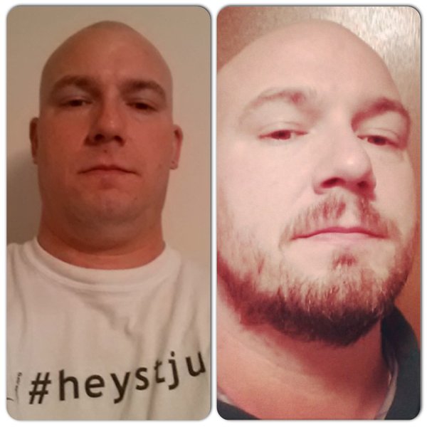Brad's Before and After