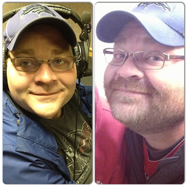 Matthew J's Before and After
