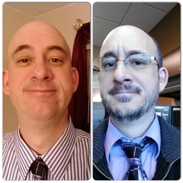 Randy's Before and After