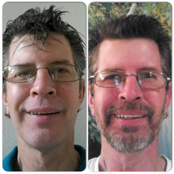 Rick's Before and After