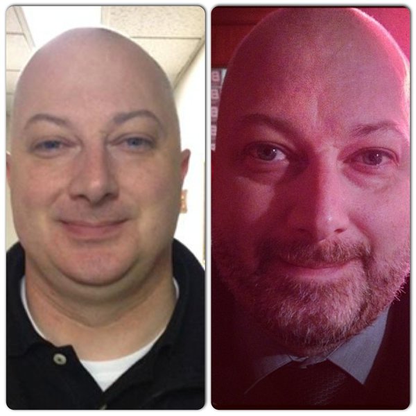 Robert's Before and After