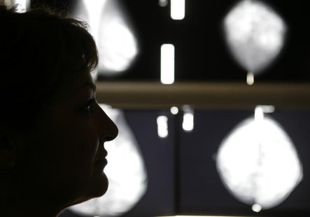 Vasiliki Kostoula, a Greek breast cancer patient, listens to her doctor after a radiological medical examination in an Athens hospital Octob Vasiliki Kostoula, a Greek breast cancer patient, listens to her doctor after a radiological medical examination in an Athens hospital Octob